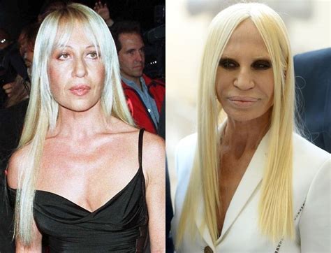 commento di donatella versace a virginia|donatella versace before and after.